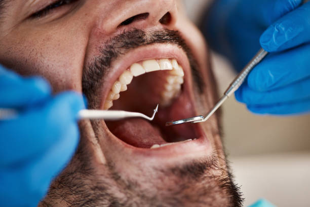 Best Urgent Care for Lost Fillings or Crowns in Springfield, NE