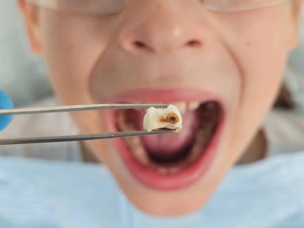 Best Pediatric Emergency Dentist in Springfield, NE